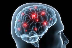 traumatic brain injury