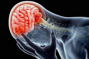 traumatic brain injury